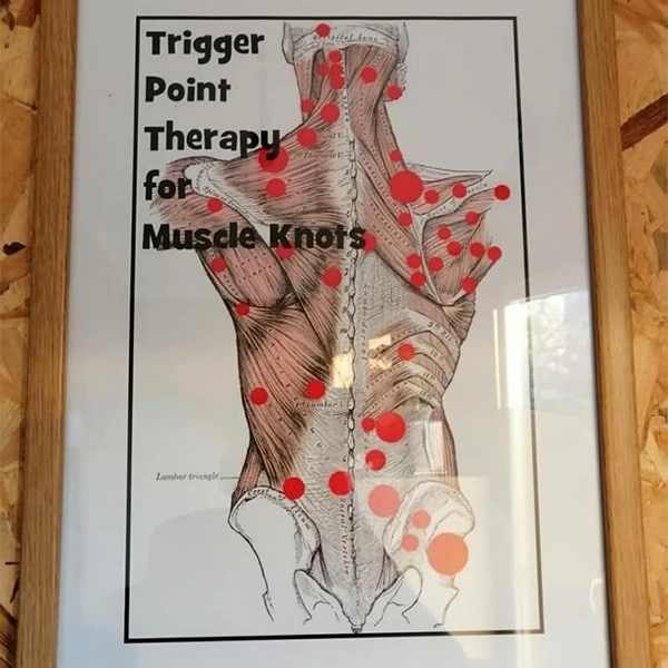 teretana ms masaža slika mišićnih čvorova
